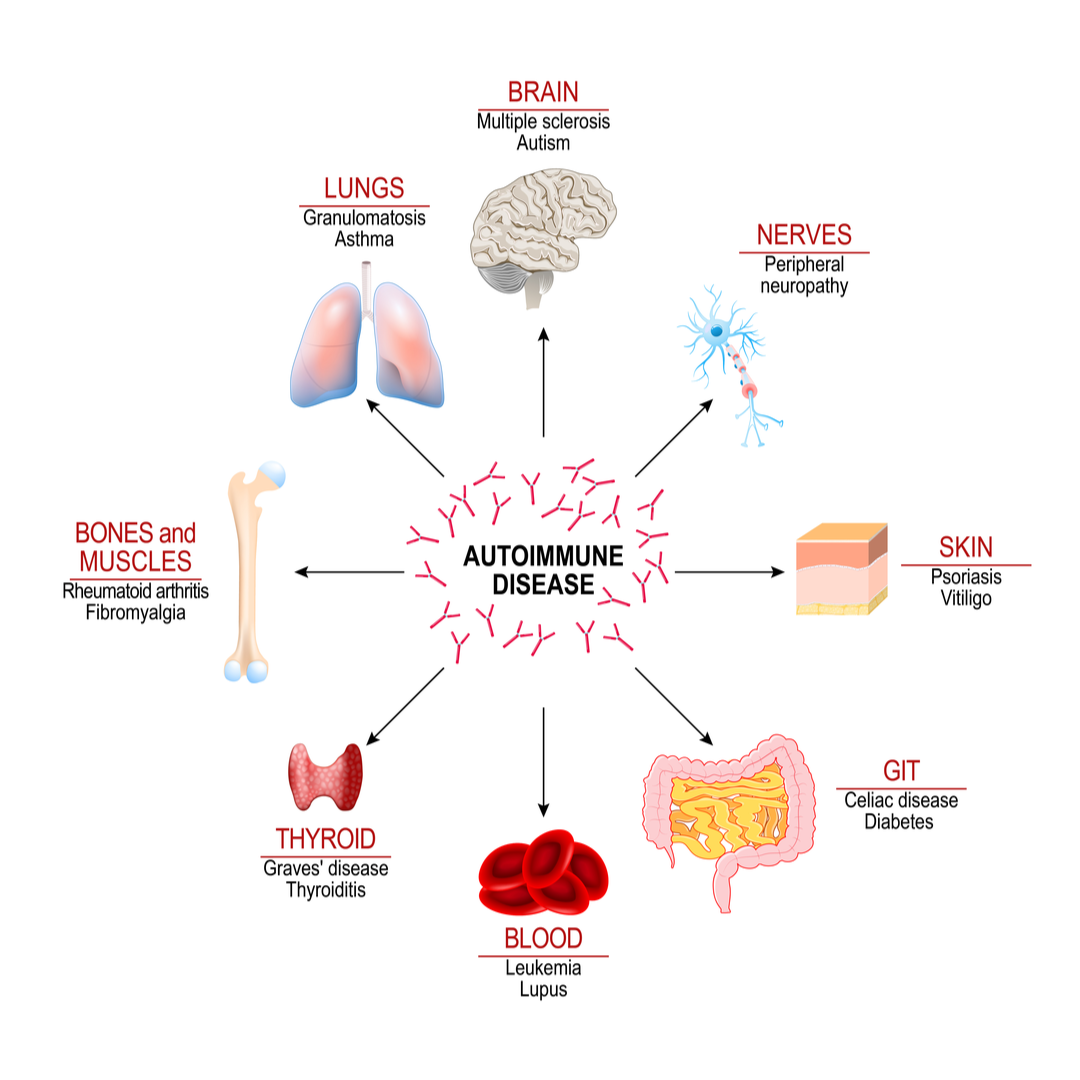 What is Autoimmune Disease? โ Daiwa Health Development, Inc